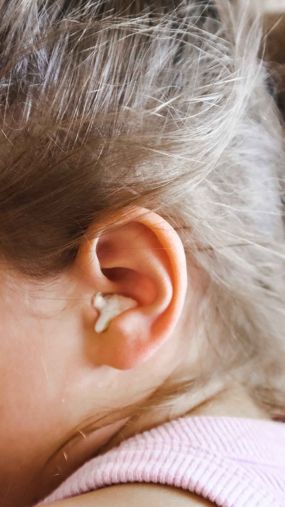 How to Treat Ear Infections Naturally Progress over Perfect